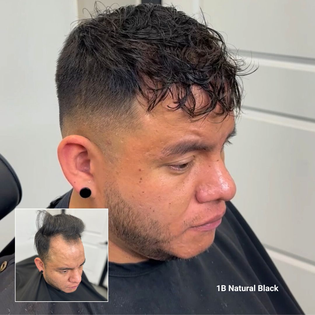 Hair loss Client before and after with Straight Hair System, color 1B Natural Black, light to medium density