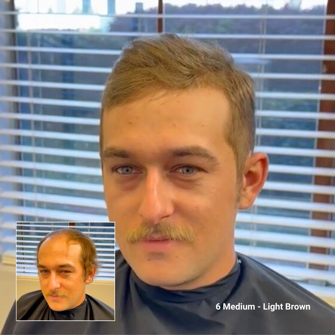 Client before and after with Straight Hair System, color 6 medium to Light Brown, hair loss solution.